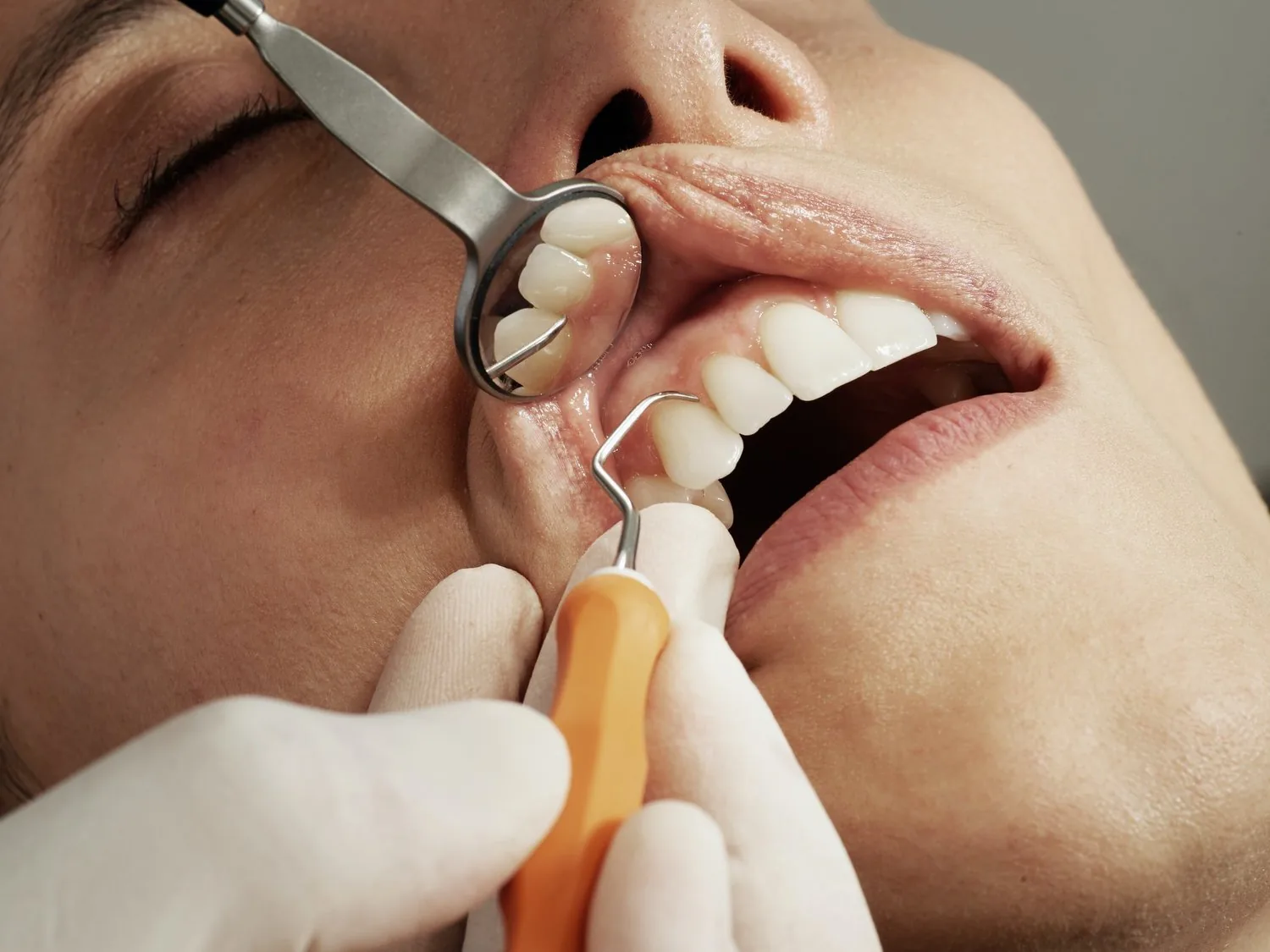 A patient's teeth being examined with a dental mirror